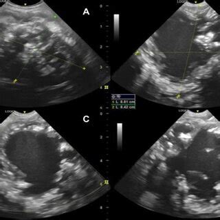 Ultrasonographic Images Demonstrating The Characteristics Of The