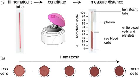 The Hematocrit Effect A Blood Samples Are Collected Into A