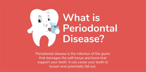 Infographic Visual Guide To Periodontal Disease