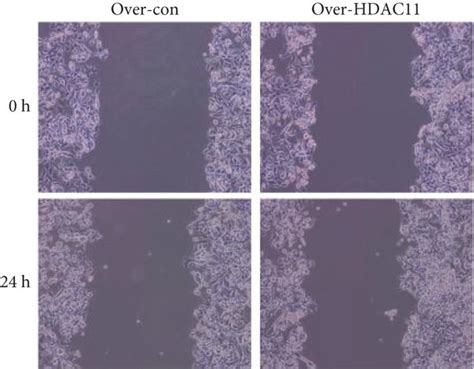 The effect of HDAC11 in liver cancer. HepG2 cell transfected with ... 