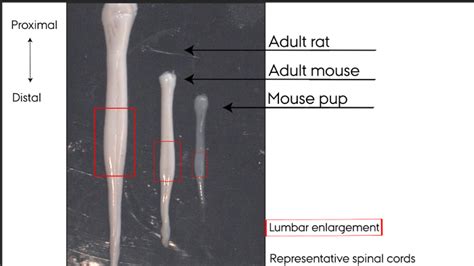 Representative Spinal Cords Hydraulically Extruded Spinal Cords Left Download Scientific