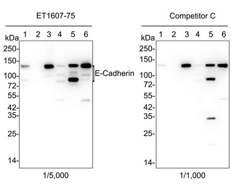 E Cadherin Recombinant Rabbit Monoclonal Antibody SY0287 ET1607 75