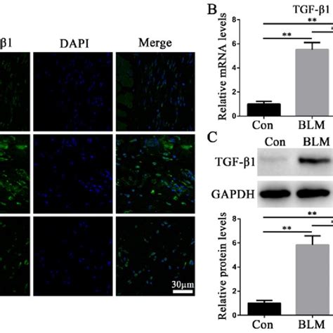 Atg Reduces The Inflammation Response In Blm Induced Skin Fibrosis