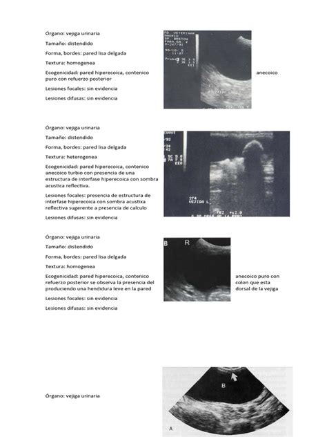 Estomago Y Vejiga Pdf Infección Del Tracto Urinario Enfermedades