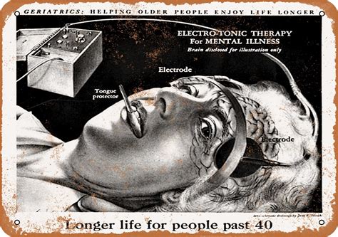 Electroshock Therapy 1950s