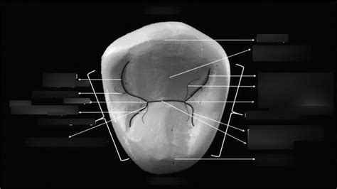 Maxillary Second Molar Occlusal Aspect Diagram Quizlet