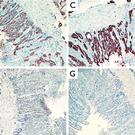 Pathological Examination Of The Patient A Histological Examination