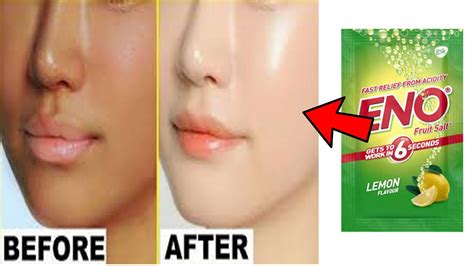 Skin Whitening With Eno Get Fair Glowing Spotless Skin Permanently