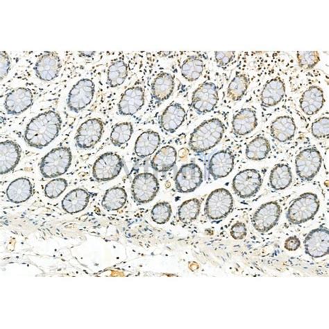 Phospho ERK1 2 Thr202 Tyr204 Thr185 Tyr187 Antibody Affinity