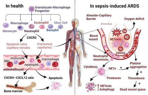 Neutrophil Sepsis Hot Sex Picture