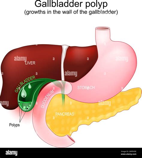 Bladder Wall Stock Vector Images Alamy