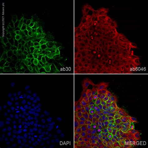 Anti-EGFR antibody [EGFR1] (ab30) | Abcam