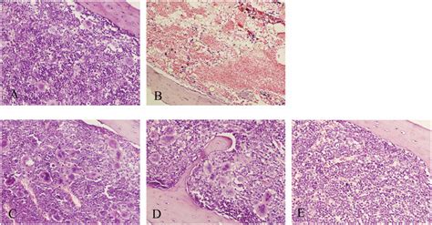 Influence Of Rrps On Histopathological Changes In Bone Marrow In Mice