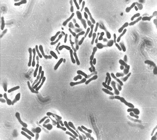 Bifidobacterium longum subsp. infantis | Courtesy of Paola M… | Flickr