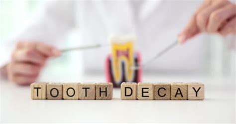 Stages Of Tooth Decay Videos Royalty Free Stock Stages Of Tooth