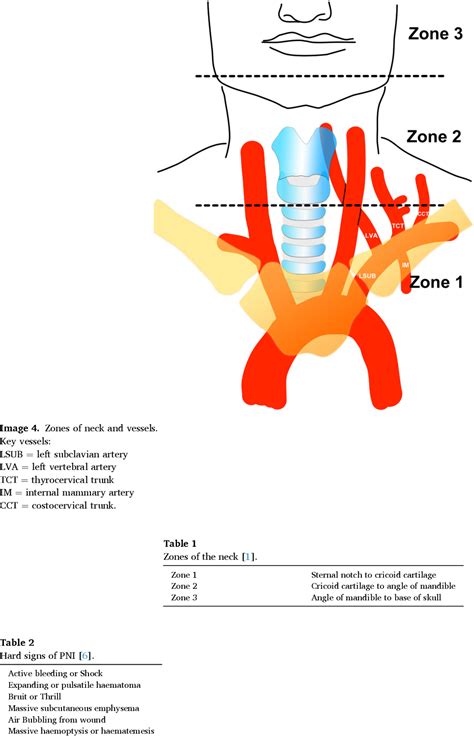 Table 2 From An Unusual Case Of A Penetrating Neck Injury Pni Illustrating The Use Of A “no