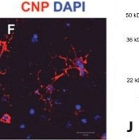 抗 CNPase单克隆抗体 小鼠抗