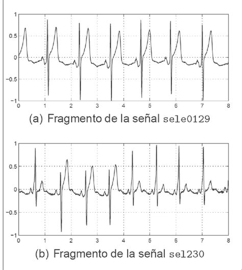 Señales ECG usadas para las pruebas comparativas Download Scientific