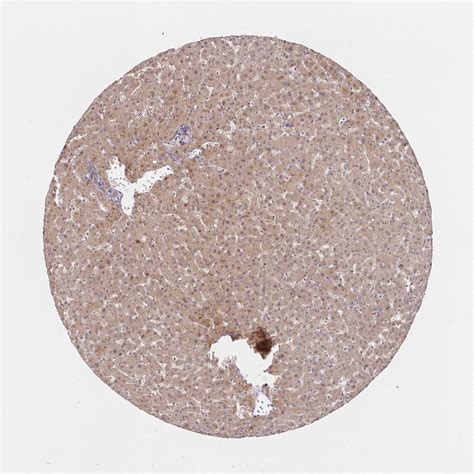 Tissue Expression Of Hepn Staining In Liver The Human Protein Atlas