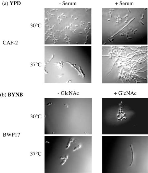 Morphology Of Candida Albicans In Hypha Inducing Conditions A Yeast Download Scientific