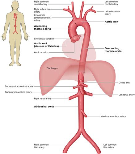 2022 Accaha Guideline For The Diagnosis And Management Of Aortic