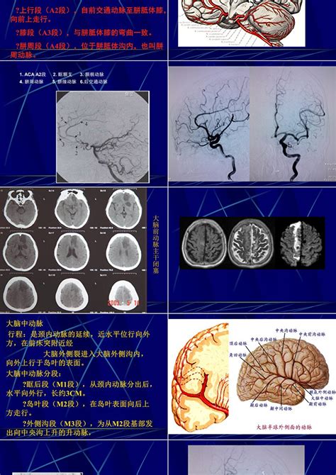 脑血管解剖及造影术学习ppt模板卡卡办公