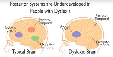 Dyslexia Educational Leadership