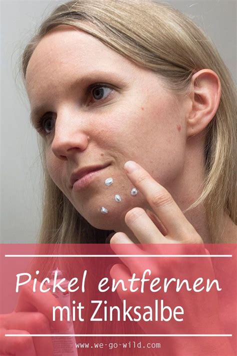 Zinksalbe Gegen Pickel So Wirkt Das Wundermittel Bei Unreiner Haut