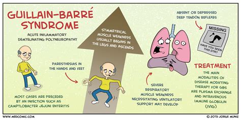 Guillain Barr Syndrome Medcomic