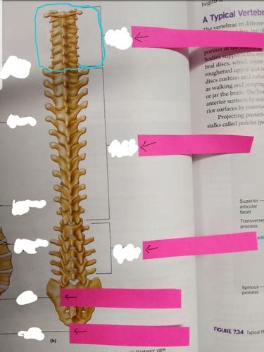 Anatomyandphysiology Vertebral Column Posterior Flashcards Quizlet