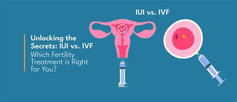 Iui Vs Ivf Which Fertility Treatment Is Right For You