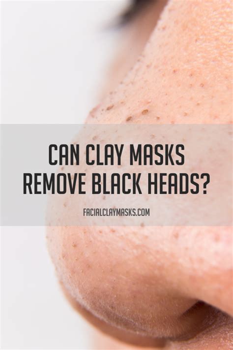 Can a Clay Mask remove Blackheads?