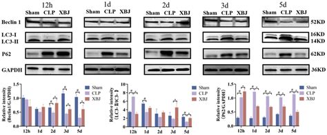 Xuebijing Injection Protects Against Sepsis Induced Myocardial Injury