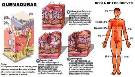 LÁMINAS DIDÁCTICAS Conoce un poco sobre las quemaduras Anatomia del