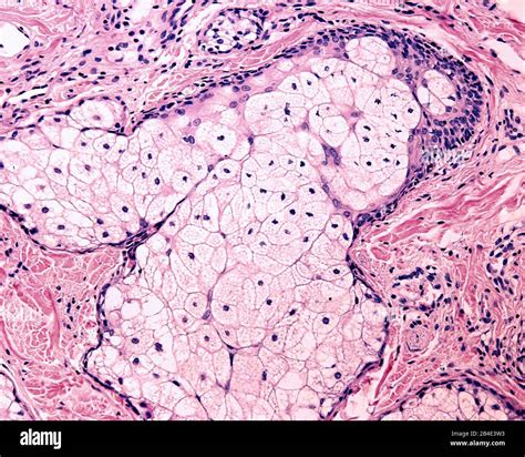 The Sebaceous Gland Is A Holocrine Gland Which Secrete Sebum The Cells