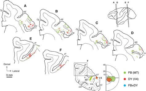 Distribution Patterns Of Retrograde Labeling In Fef And Lip After