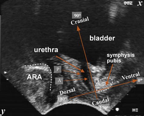 Typical Transperineal View On An Ultrasound Scan With Co Ordinate