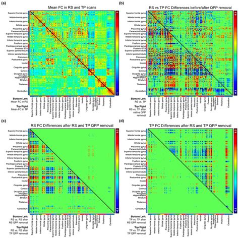 Quasi Periodic Patterns Contribute To Functional Connectivity In The Brain Pmc