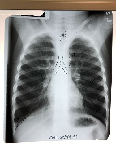 RADS 2010 Thorax Chest Abdomen Ws 4 Flashcards Quizlet