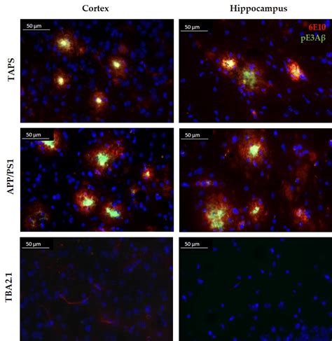 Comparison Of The Plaque Morphology In Taps App Ps1 And Tba2 1 Mice