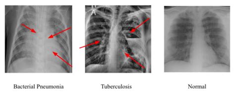 Determining The Best Convolutional Neural Network For Identifying