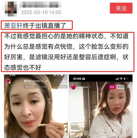 蕭亞軒受傷一年首出鏡，疤痕明顯精神飄忽，滿臉憔悴狀態堪憂 每日頭條