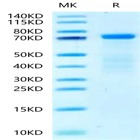 Human HRG HPRG Protein HRG HM101 KACTUS Biosystems Ushelf