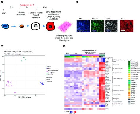 Differentiation Of Patient Derived IPSCs To Lung Progenitor Cells A