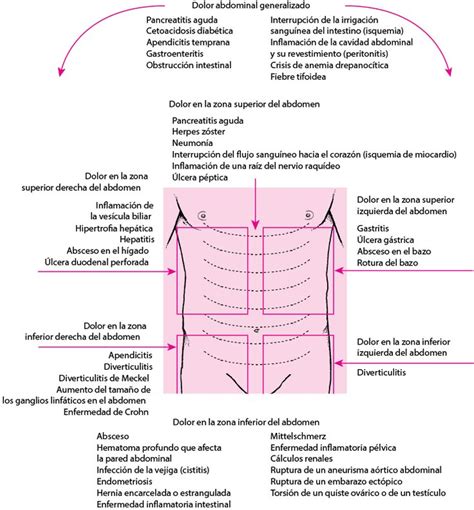 Dolor Abdominal Agudo Trastornos Gastrointestinales Manual Msd Versión Para Público General