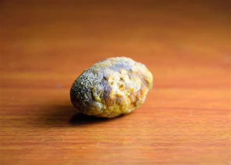 Large Gallstone Gall Bladder Stone The Result Of Gallstones Stock