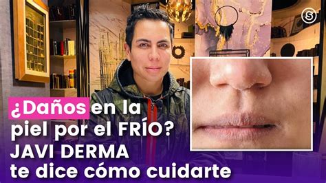 Javi Derma Nos Ense A C Mo Prevenir Da Os En La Piel Por El Fr O Youtube