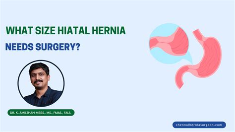 What Size Hiatal Hernia Needs Surgery More Than Cm