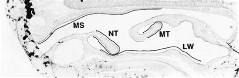 Low Power Light Micrograph Of The Nasal Septum Of A Rat The Three