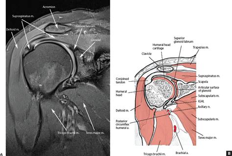 Normal Shoulder Mri Anatomy